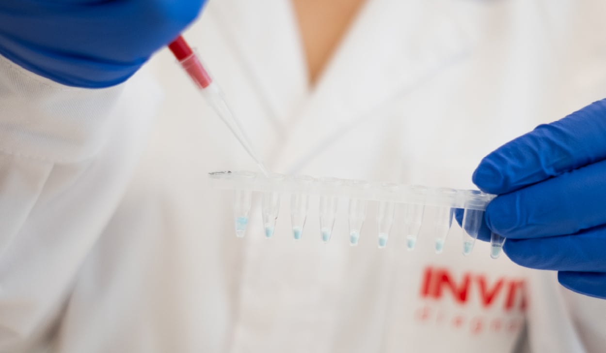 LAMP molecular testing for point-of-care and point-of-use applications